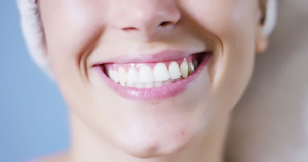 How Dental Bonding Can Restore Your Smile